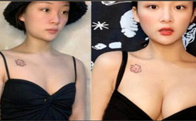 洛陽華美醫(yī)療美容醫(yī)院做假體隆胸怎么樣？看我就知道啦！